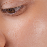 [Scandy] Spot the F Off Invisible Blemish Patches (24ea)